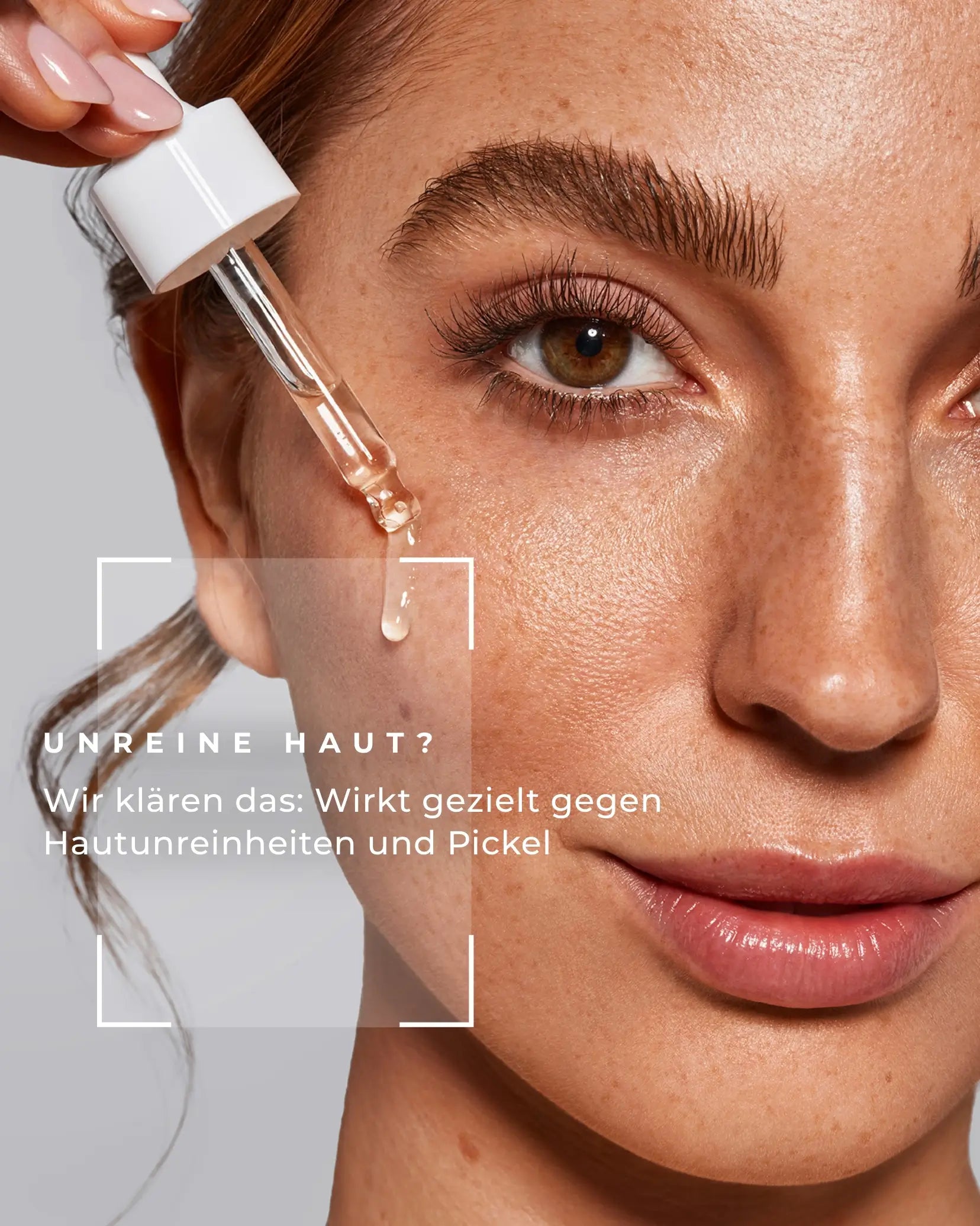 Beauty Mates Clear Skin Booster - Gezielte Wirkung gegen Hautunreinheiten und Pickel